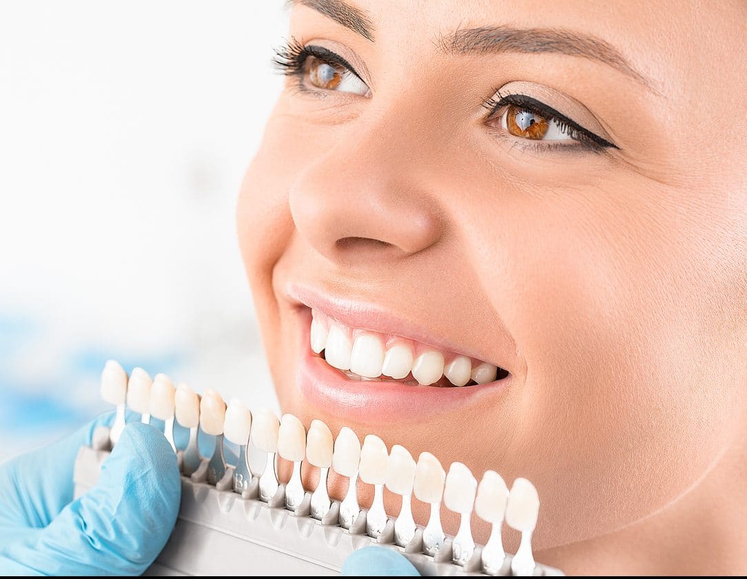 tips for whitening your teeth