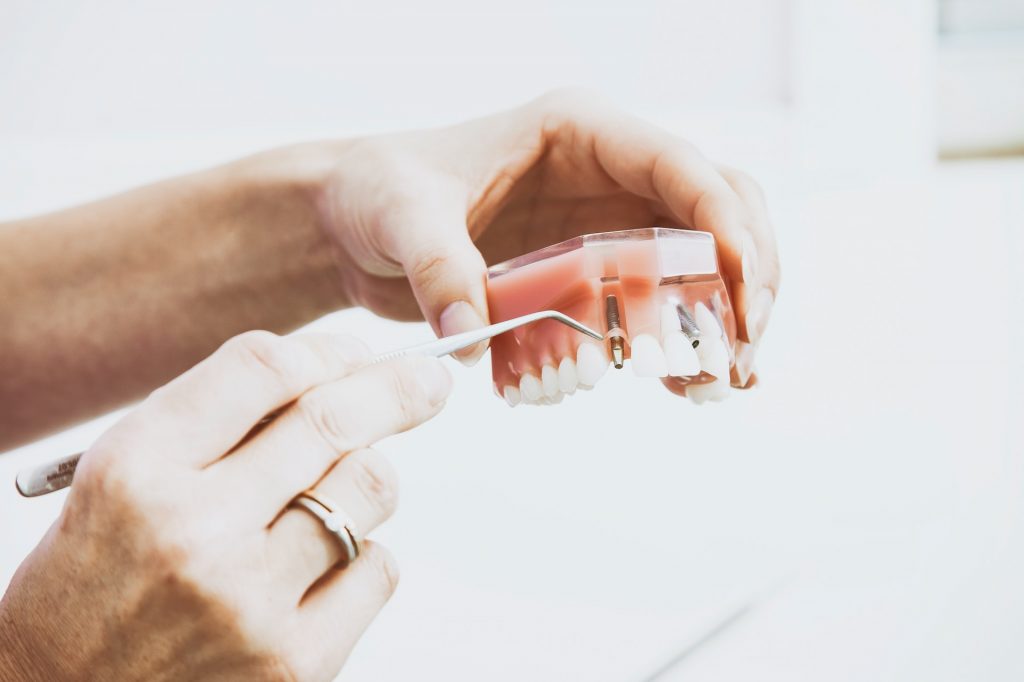 The Benefits Of Dental Implants For Senior Citizens